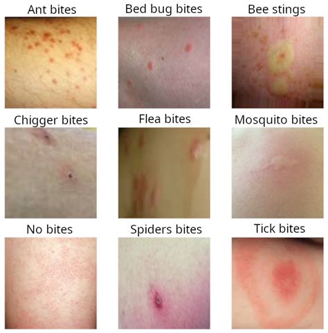 are spider bites similar to bed bug bites